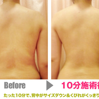 【2023年購入、10回程使用、美品】ハイパーナイフ 2023年購入、10回程使用、美品】ハイパーナイフ